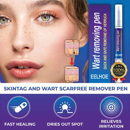 EELHOE Wart Removal Pen